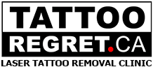 PicoSure Laser Tattoo Removal | TATTOOREGRET.CA