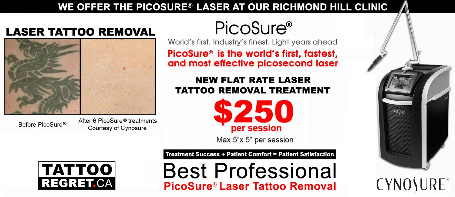 Picosure laser tattoo removal