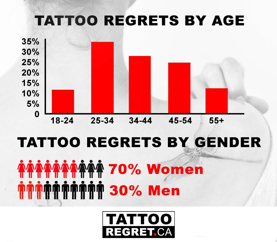 laser tattoo removal Toronto stats
