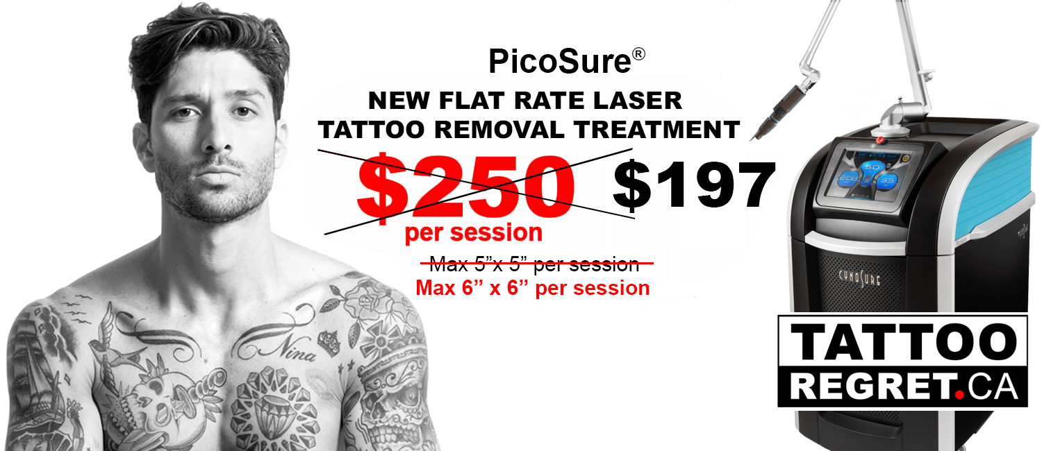 Laser Services in Raleigh NC | Laser tattoo removal, Tattoo removal cost, Tattoo  removal