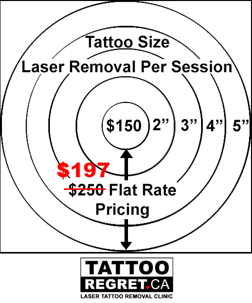 picosure tattoo removal toronto