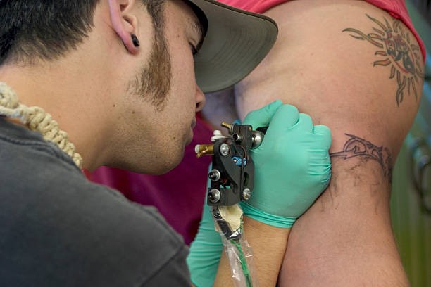 Laser Tattoo Removal: A Comprehensive Guide to Safe and Effective Tattoo Removal