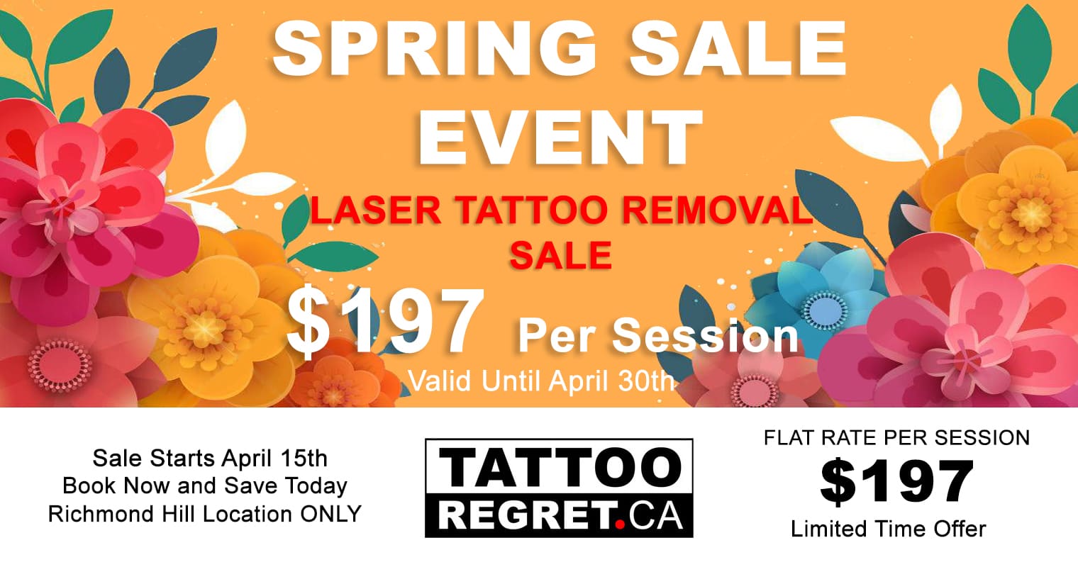 Laser-Tattoo-Removal-Toronto-Tattoo-Regret