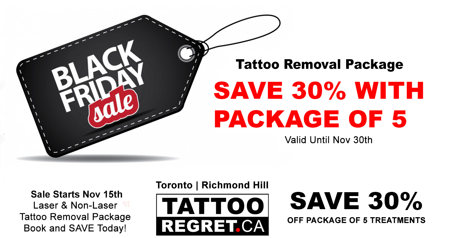 laser-tattoo-removal-tattoo-regret-Toronto