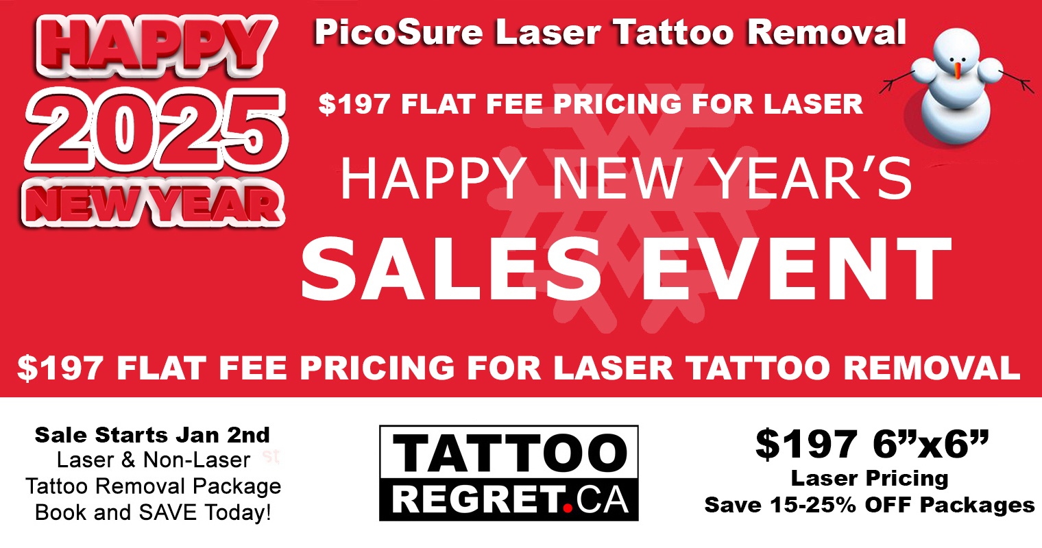 laser-tattoo-removal-cost