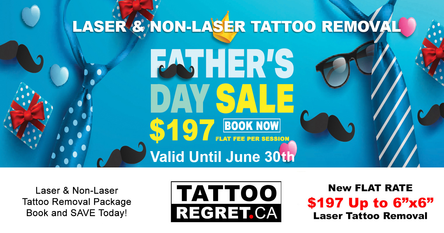 Laser-Tattoo-Removal-Toronto-Tattoo-Regret