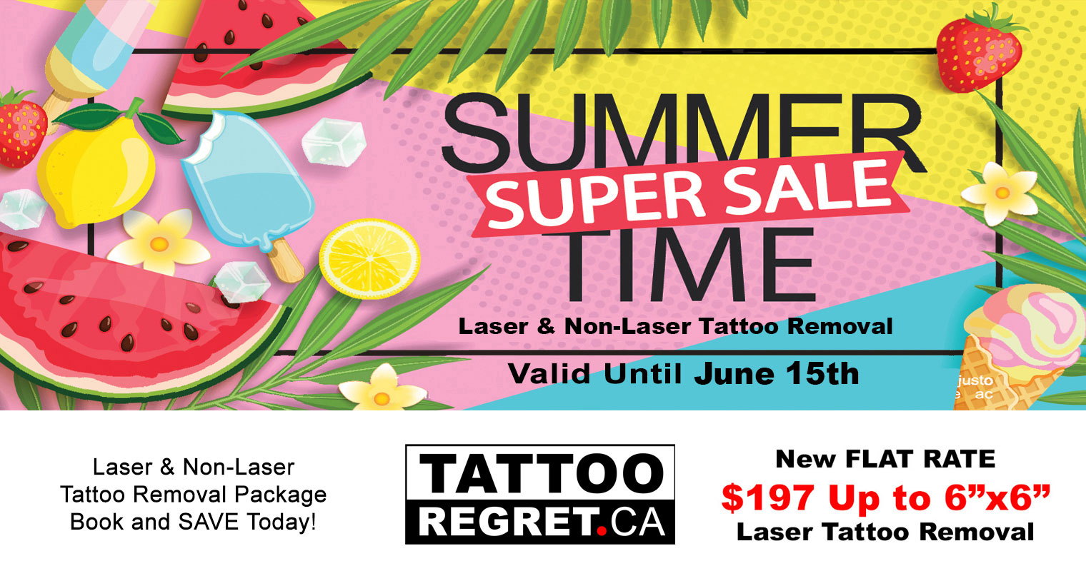 laser-tattoo-removal-Toronto