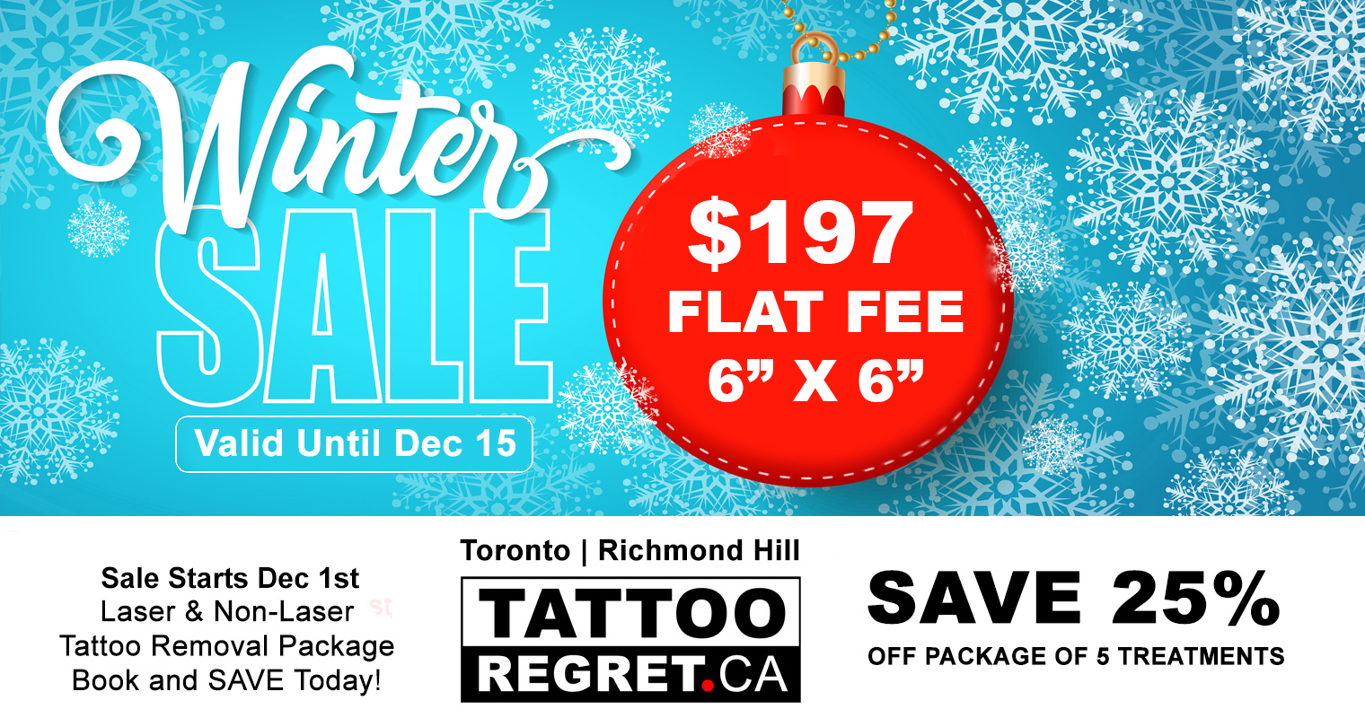 laser tattoo removal Toronto